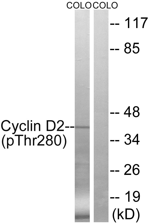 Cyclin D2 (Phospho-Thr280)