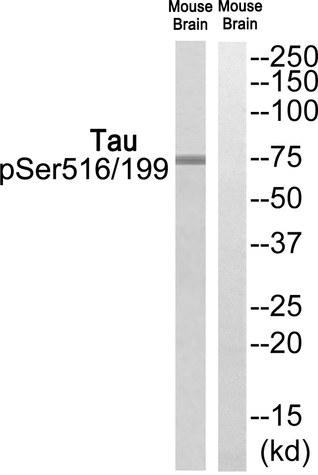 Tau (Phospho-Ser516/199)