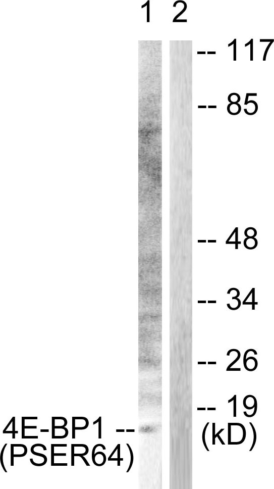 4E-BP1 (Phospho-Ser65)