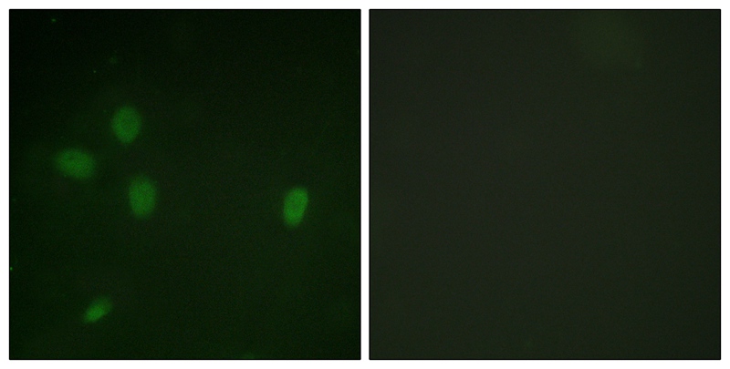 53BP1 (Phospho-Ser25)