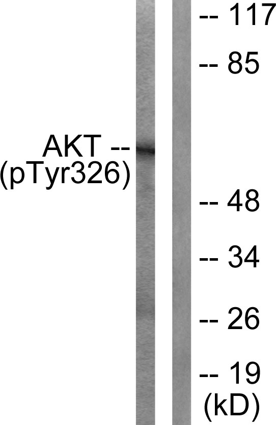 Akt (Phospho-Tyr326)