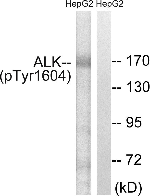 ALK (Phospho-Tyr1604)