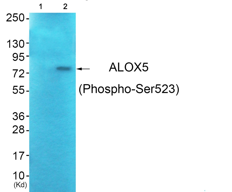 Rabbit Polyclonal Antibody to ALOX5 (Phospho-Ser523)
