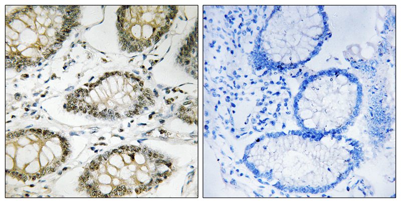 ATR (Phospho-Ser428)