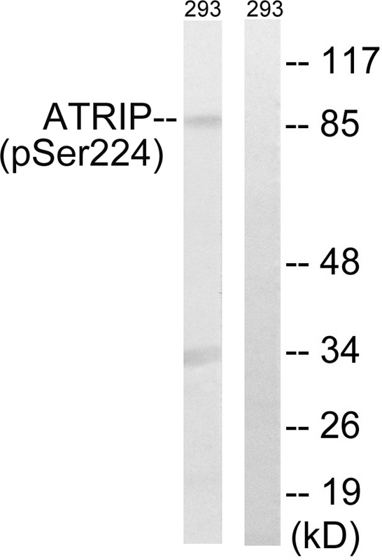 ATRIP (Phospho-Ser224)