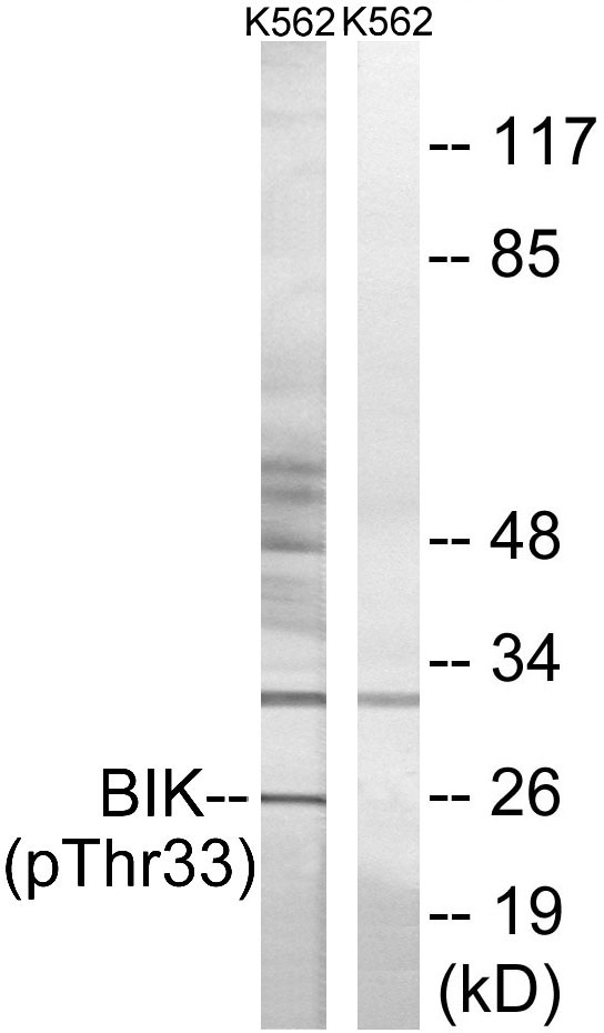 BIK (Phospho-Thr33)