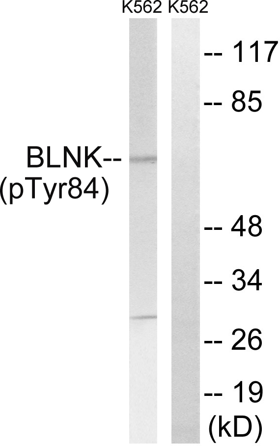 BLNK (Phospho-Tyr84)