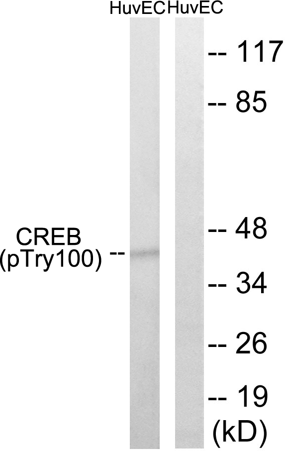 CREB (Phospho-Thr100)
