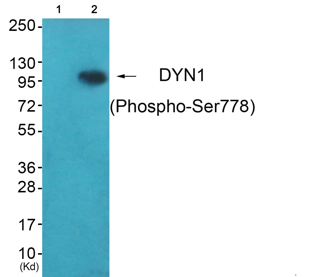 Rabbit Polyclonal Antibody to DYN1 (Phospho-Ser778)