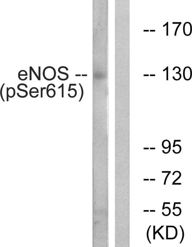 eNOS (Phospho-Ser615)