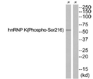 hnRNP K (Phospho-Ser216)