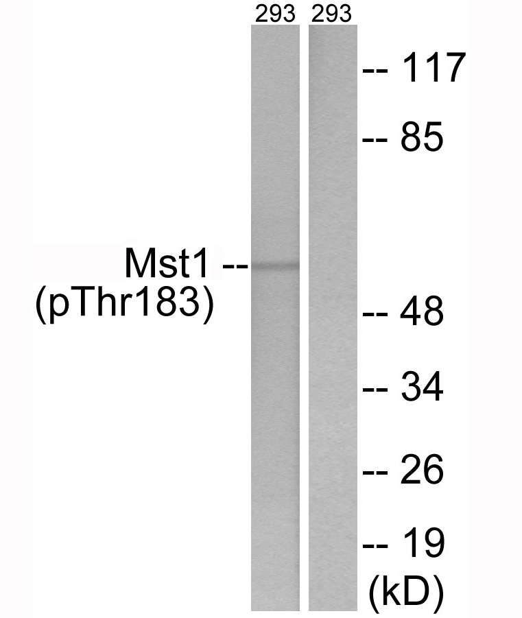 Mst1 (Phospho-Thr183)
