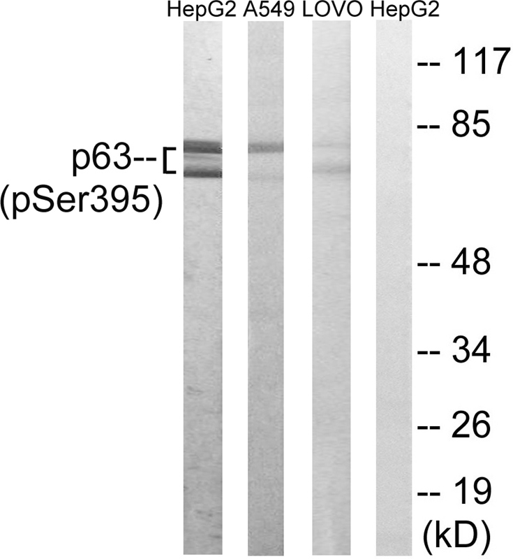 p63 (Phospho-Ser395)