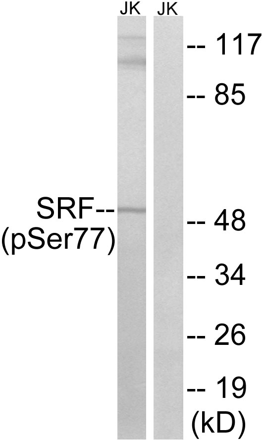 SRF (Phospho-Ser77)