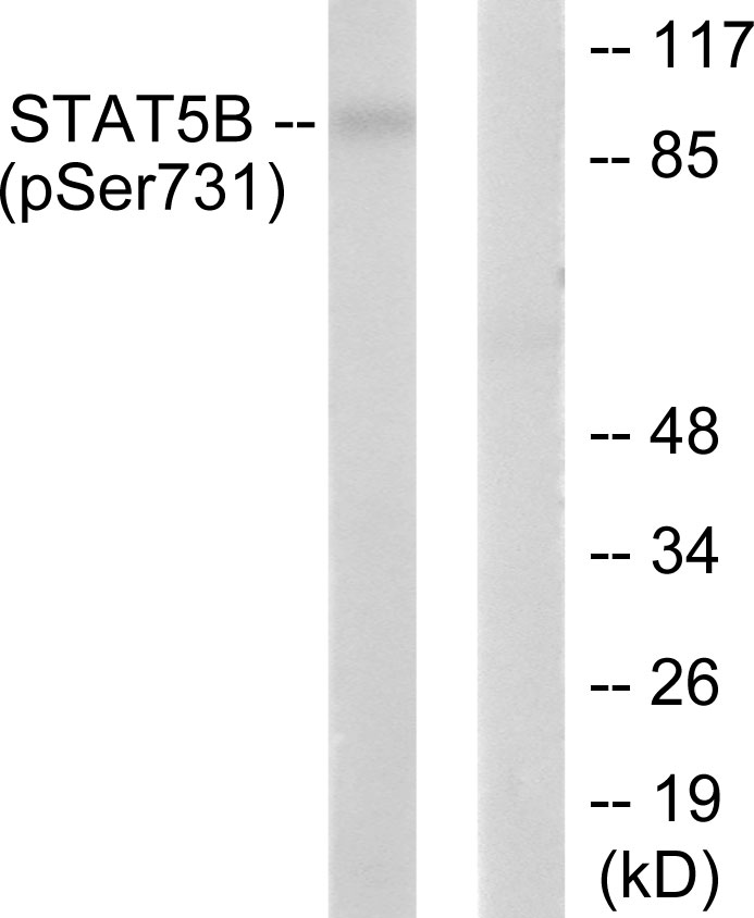 STAT5B (Phospho-Ser731)