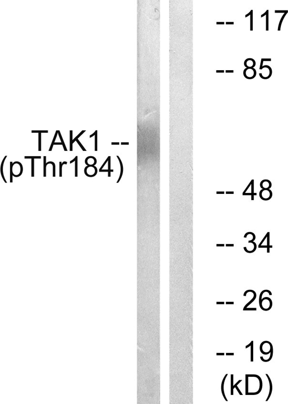 TAK1 (Phospho-Thr184)