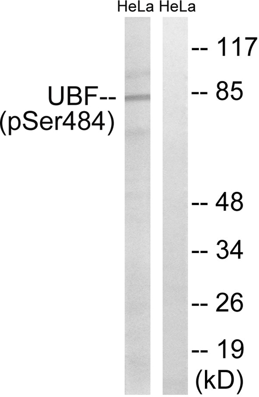 UBF (Phospho-Ser484)