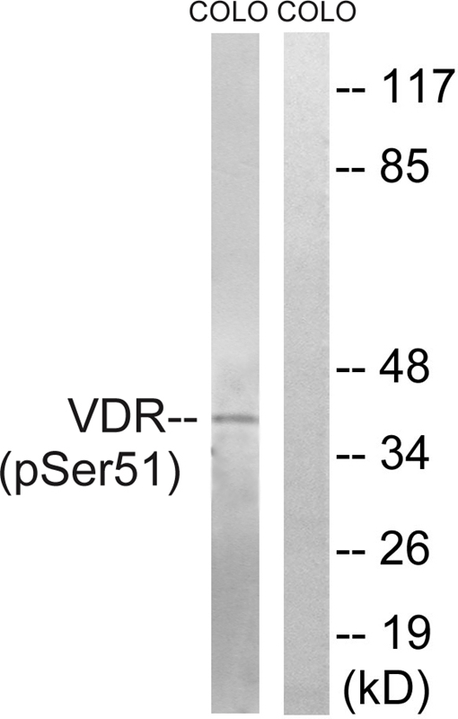 Vitamin D3 Receptor (Phospho-Ser51)