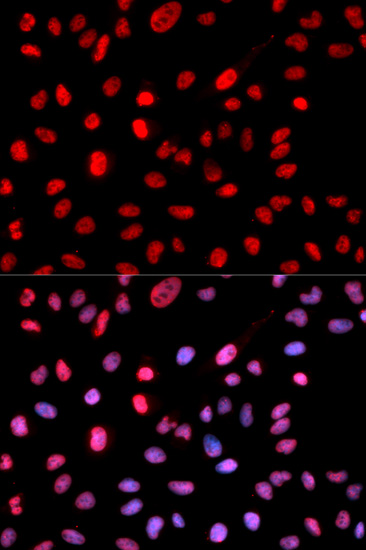 Dnmt1(Phospho-Ser714)