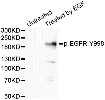 EGFR(Phospho-Tyr998)