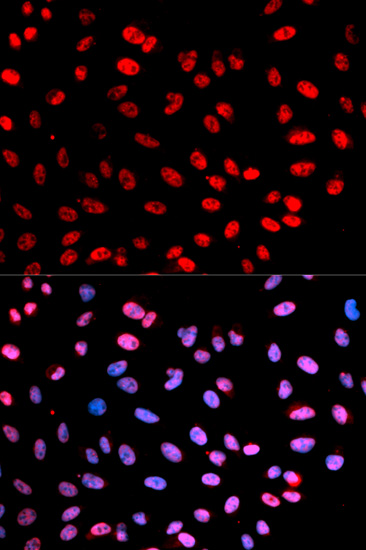 ESPL1(Phospho-S1126/801)