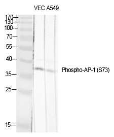 Rabbit Polyclonal Antibody to AP-1/Jun D (Phospho-Ser73/100)