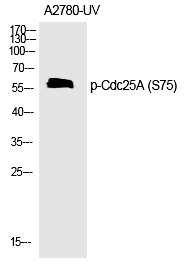 Cdc25A (Phospho-Ser75)