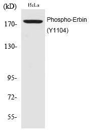 Erbin (Phospho-Tyr1104)