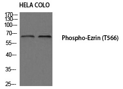 Ezrin (Phospho-Thr566)