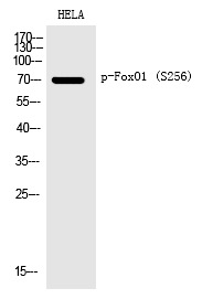 FoxO1 (Phospho-Ser256)