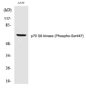 p7S6 kinase α (Phospho-Ser447)