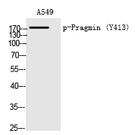 Pragmin (Phospho-Tyr413)