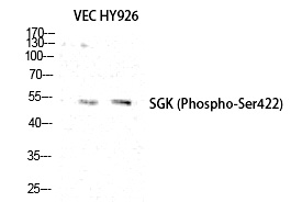 SGK1 (Phospho-Ser422)