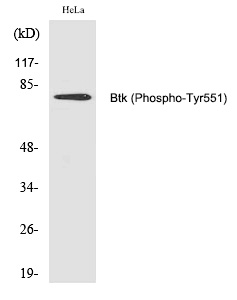 Btk (Phospho-Tyr551)