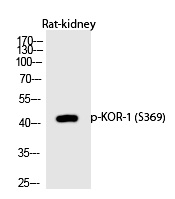 KOR-1 (Phospho-Ser369)