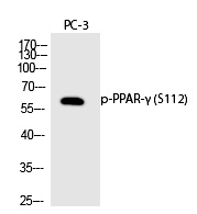 PPAR-γ (Phospho-Ser112)