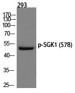 SGK1 (Phospho-Ser78)