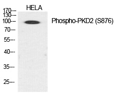 Rabbit Polyclonal Antibody to PKD2 (Phospho-Ser876)