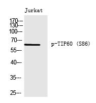 TIP6(Phospho-Ser86)
