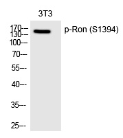 Ron (Phospho-Ser1394)