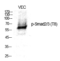 Rabbit Polyclonal Antibody to Smad2/3 (Phospho-Thr8)