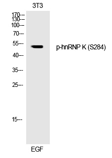 hnRNP K (Phospho-Ser284)
