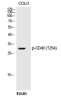 CD4(Phospho-Thr254)