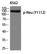 Neu (Phospho-Tyr1112)