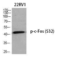 c-Fos (Phospho-Ser32)