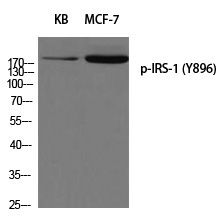 IRS-1 (Phospho-Tyr896)