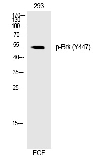 Brk (Phospho-Tyr447)