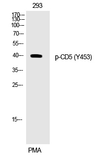 CD5 (Phospho-Tyr453)