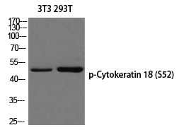 Cytokeratin 18 (Phospho-Ser52)
