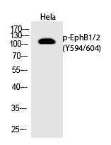 EphB1/2 (Phospho-Tyr594/604)